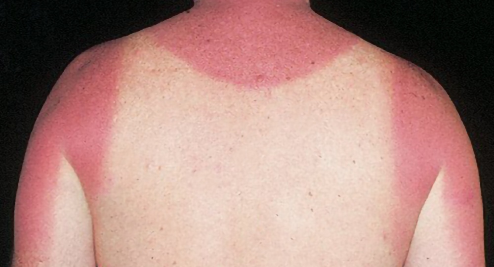 Siim Elmers Tartu Kunstimajas